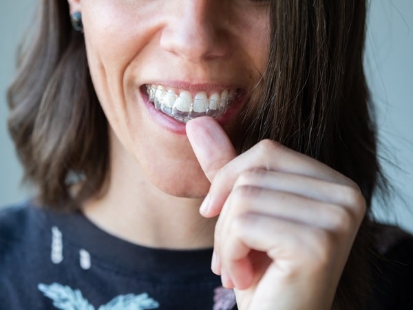 getting-a-retainer-made