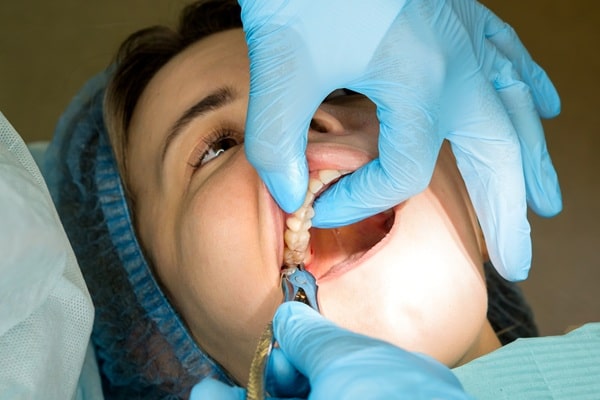 what-to-expect-during-the-procedure